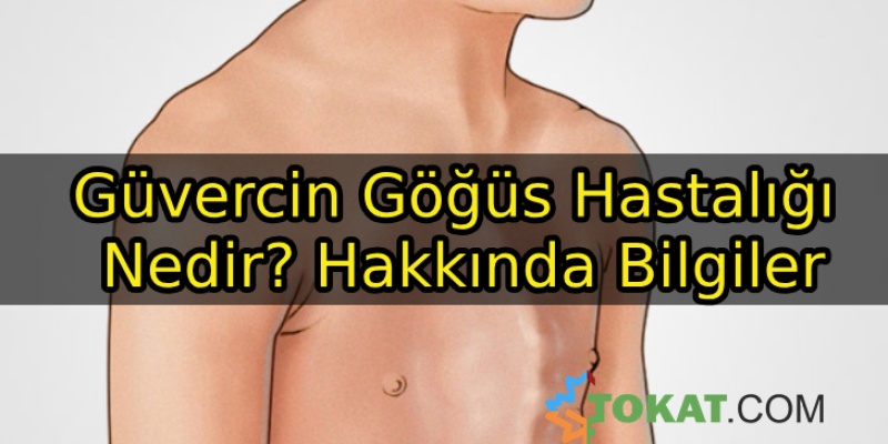 Güvercin Göğüs Hastalığı Nedir? Hakkında Bilgiler